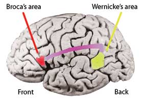 
מרכזי ברוקה וורניקה במוח